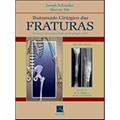 Ler Tratamento Cirurgico Das Fraturas - 02ed/02, do autor Schatzker, Joseph E Tile, Marvin