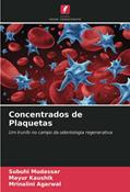 Ler Concentrados de Plaquetas: Um trunfo no campo da odontologia regenerativa, do autor Subuhi Mudassar; Mayur Kaushik; Mrinalini Agarwal