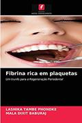 Ler Fibrina rica em plaquetas: Um trunfo para a Regeneração Periodontal, do autor LASHIKA TAMBE PHONDKE; MALA DIXIT BABURAJ Ler Fibrina rica em plaquetas: Um trunfo para a Regeneração Periodontal, do autor LASHIKA TAMBE PHONDKE; MALA DIXIT BABURAJ