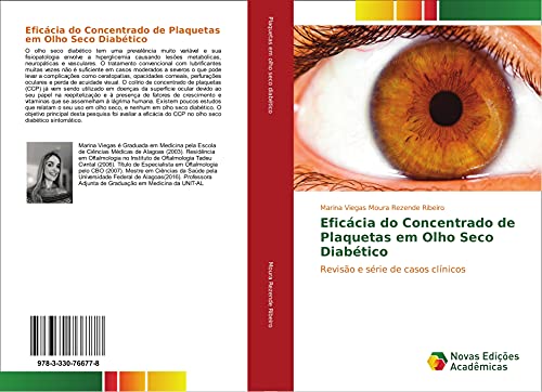 Ler Eficácia do Concentrado de Plaquetas em Olho Seco Diabético: Revisão e série de casos clínicos, do autor Marina Viegas Moura Rezende Ribeiro Ler Eficácia do Concentrado de Plaquetas em Olho Seco Diabético: Revisão e série de casos clínicos, do autor Marina Viegas Moura Rezende Ribeiro
