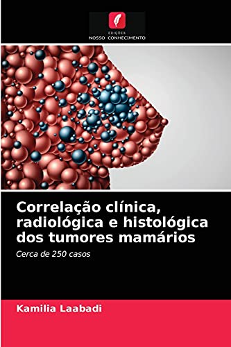 Ler Correlação clínica, radiológica e histológica dos tumores mamários: Cerca de 250 casos, do autor Kamilia Laabadi Ler Correlação clínica, radiológica e histológica dos tumores mamários: Cerca de 250 casos, do autor Kamilia Laabadi