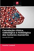 Ler Correlação clínica, radiológica e histológica dos tumores mamários: Cerca de 250 casos, do autor Kamilia Laabadi Ler Correlação clínica, radiológica e histológica dos tumores mamários: Cerca de 250 casos, do autor Kamilia Laabadi