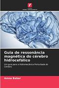 Ler Guia de ressonância magnética do cérebro hidrocefálico: Um guia para a Hidromecânica Perturbada do Cérebro, do autor Amna Babar