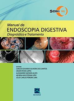 Manual de endoscopia digestiva - SOBED/RS: Diagnóstico e Tratamento, do autor Carlos Eduardo Oliveira dos Santos; César Vivian Lopes; Júlio Carlos Pereira Lima; Alexandro Vaesken Alves; Ari Ben-Hur Stefani 
