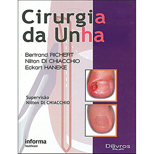 Ler Cirurgia Da Unha, do autor Di Chiacchio Nilton; Haneke Eckart; Richert Bertrand Ler Cirurgia Da Unha, do autor Di Chiacchio Nilton; Haneke Eckart; Richert Bertrand