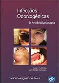 Ler Infecções Odontogênicas e Antibioticoterapia, do autor Luciano Augusto de Jesus Ler Infecções Odontogênicas e Antibioticoterapia, do autor Luciano Augusto de Jesus