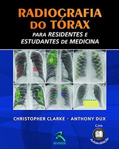 Radiografia do Tórax, do autor Christopher Clarke