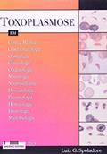Ler Toxoplasmose em Clínica Médica, Gastronterologia, Obstetrícia, Ginecologia, Oftalmologia, Neurologia, do autor Luiz G. Spoladore Ler Toxoplasmose em Clínica Médica, Gastronterologia, Obstetrícia, Ginecologia, Oftalmologia, Neurologia, do autor Luiz G. Spoladore
