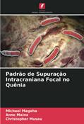 Ler Padrão de Supuração Intracraniana Focal no Quênia, do autor Michael Magoha; Anne Maina; Christopher Musau Ler Padrão de Supuração Intracraniana Focal no Quênia, do autor Michael Magoha; Anne Maina; Christopher Musau