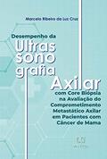 Ler Desempenho da ultrassonografia axilar com core biópsia na avaliação do comprometimento metastático axilar em pacientes com câncer de mama, do autor Marcelo Ribeiro da Luz Cruz