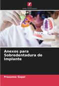 Ler Anexos para Sobredentadura de Implante, do autor Prasanna Gopal Ler Anexos para Sobredentadura de Implante, do autor Prasanna Gopal