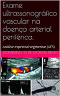Ler Exame ultrassonográfico vascular na doença arterial periférica.: Análise espectral segmentar (AES), do autor Domingos de Morais Filho Ler Exame ultrassonográfico vascular na doença arterial periférica.: Análise espectral segmentar (AES), do autor Domingos de Morais Filho