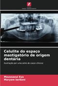 Ler Celulite do espaço mastigatório de origem dentária: Ilustração por uma série de casos clínicos, do autor Moussaoui Eya; Maryem Kerkeni