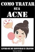 Ler Como Tratar sua Acne: Livre-se de Espnhas e Cravos, do autor Marcus Helman Ler Como Tratar sua Acne: Livre-se de Espnhas e Cravos, do autor Marcus Helman