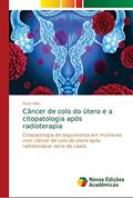 Ler Câncer de colo do útero e a citopatologia após radioterapia: Citopatologia de seguimento em mulheres com câncer de colo do útero após radioterapia: serie de casos, do autor Ruan Silva Ler Câncer de colo do útero e a citopatologia após radioterapia: Citopatologia de seguimento em mulheres com câncer de colo do útero após radioterapia: serie de casos, do autor Ruan Silva