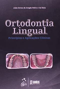 Ortodontia Lingual - Principios E Aplicacoes Clinicas, do autor Julio Orrico De Aragao Pedra
