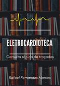 Ler Eletrocardioteca: consulta rápida de traçados, do autor Rafael Martins