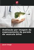 Ler Avaliação por imagem do espessamento da parede da vesícula biliar, do autor Jasvir Singh Ler Avaliação por imagem do espessamento da parede da vesícula biliar, do autor Jasvir Singh
