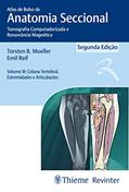 Ler Atlas de Bolso de Anatomia Seccional - Tomografia Computadorizada e Ressonância Magnética - Volume III: Coluna Vertebral, Extremidades e Articulações: Volume 3, do autor Torsten B. Moeller Ler Atlas de Bolso de Anatomia Seccional - Tomografia Computadorizada e Ressonância Magnética - Volume III: Coluna Vertebral, Extremidades e Articulações: Volume 3, do autor Torsten B. Moeller