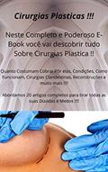 Ler Cirurgias Plasticas, do autor Digital Horizon Ler Cirurgias Plasticas, do autor Digital Horizon