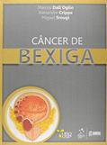 Ler Câncer De Bexiga, do autor MIGUEL SROUGI