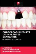 Ler COLOCAÇÃO IMEDIATA DE IMPLANTES DENTÁRIOS: EM SOQUETES DE EXTRACÇÃO, do autor AMIT MANI; SHIVANI SACHDEVA; JASLEEN KAUR SODHI
