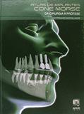 Ler Atlas de Implantes Cone Morse. Da Cirurgia à Prótese, do autor Luiz Fernando Martins André Ler Atlas de Implantes Cone Morse. Da Cirurgia à Prótese, do autor Luiz Fernando Martins André