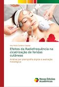 Ler Efeitos da Radiofrequência na cicatrização de feridas cutâneas: Análise por planigrafia digital e avaliação histológica, do autor Ana Maria Cardoso Cepeda