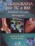 Ler Angiografia por TC e RM. Avaliação Vascular Abrangente, do autor Geoffrey D. Rubin Ler Angiografia por TC e RM. Avaliação Vascular Abrangente, do autor Geoffrey D. Rubin
