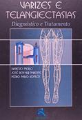 Ler Varizes e Telangiectasias: Diagnóstico e Tratamento, do autor Ivanésio Merlo; José Ben-Hur Parente; Pedro Pabl Komlós Ler Varizes e Telangiectasias: Diagnóstico e Tratamento, do autor Ivanésio Merlo; José Ben-Hur Parente; Pedro Pabl Komlós