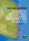 Ler Enxertos Ósseos para Implantes na Maxila, do autor Karl-Erik Kahnberg Ler Enxertos Ósseos para Implantes na Maxila, do autor Karl-Erik Kahnberg