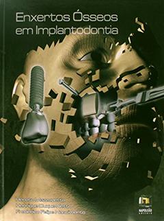 Enxertos Ósseos em Implantodontia, do autor Henrique Duque Netto; Renato Mazzonetto; Frederico Felipe Nascimento