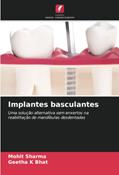 Ler Implantes basculantes: Uma solução alternativa sem enxertos na reabilitação de mandíbulas desdentadas, do autor Mohit Sharma; Geetha K Bhat Ler Implantes basculantes: Uma solução alternativa sem enxertos na reabilitação de mandíbulas desdentadas, do autor Mohit Sharma; Geetha K Bhat