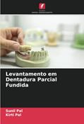 Ler Levantamento em Dentadura Parcial Fundida, do autor Sunil Pal; Kirti Pal