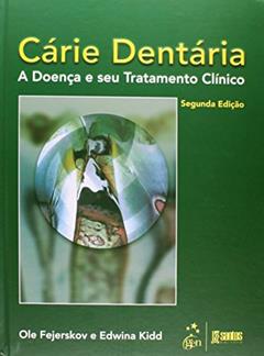 Cárie Dentária: A Doença e seu Tratamento Clínico, do autor Ole Fejerskov; Edwina Kidd