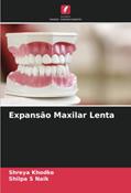 Ler Expansão Maxilar Lenta, do autor Shreya Khodke; Shilpa S Naik Ler Expansão Maxilar Lenta, do autor Shreya Khodke; Shilpa S Naik