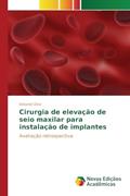 Ler Cirurgia de elevação de seio maxilar para instalação de implantes: Avaliação retrospectiva, do autor Diniz Antoniel