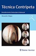 Ler Técnica Centrípeta: Etmoidectomia Endoscópica Endonasal, do autor Alexandre Felippu Ler Técnica Centrípeta: Etmoidectomia Endoscópica Endonasal, do autor Alexandre Felippu