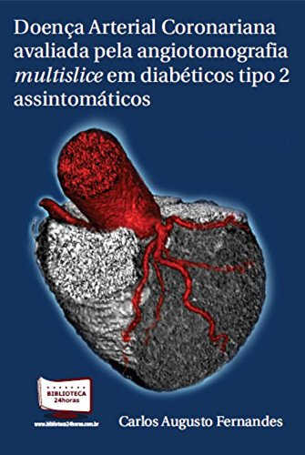 Ler Doença Arterial Coronariana Avaliada Pela Angiotomografia Multislice em Diabéticos Tipo 2 Assintomáticos, do autor Carlos Augusto Fernandes Tavares