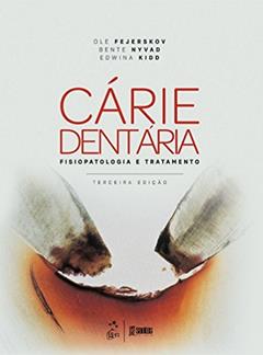 Cárie dentária: fisiopatologia e tratamento, do autor Ole Fejerskov; Bente Nyvad; Edwina Kidd