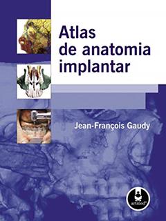 Atlas de Anatomia Implantar, do autor Jean-Francois Gaudy