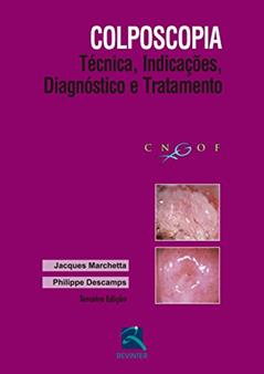 Colposcopia: Técnica, Indicações, Diagnóstico e Tratamento, do autor Jacques Marchetta