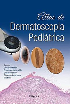 Atlas De Dermatoscopia Pediatrica, do autor Giuseppe Micali Francesco Lacarrubba Giuseppe Stinco Giuseppe Argenziano