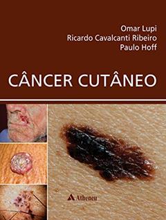 Câncer Cutâneo, do autor Ricardo Cavalcanti Ribeiro; Paulo M. Hoff Omar Lupi
