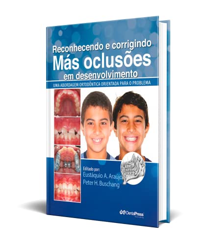 Reconhecendo e Corrigindo Más Oclusões em Desenvolvimento. Uma Abordagem Ortodôntica Orientada Para o Problema, do autor Eustáquio Afonso Araújo