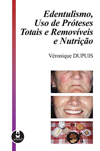 Ler Edentulismo, Uso de Próteses Totais e Removíveis e Nutrição, do autor Véronique Dupuis Ler Edentulismo, Uso de Próteses Totais e Removíveis e Nutrição, do autor Véronique Dupuis