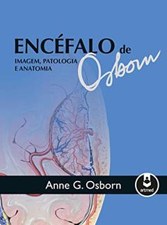 Encéfalo de Osborn: Imagem, Patologia e Anatomia, do autor Anne G. Osborn