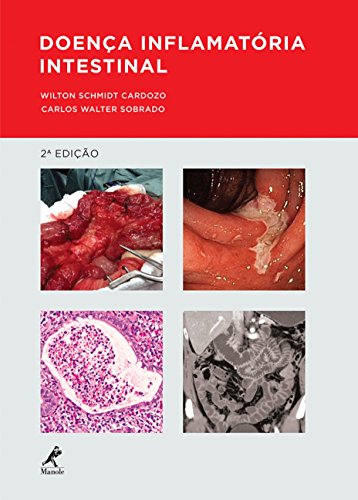 Ler Doença inflamatória intestinal, do autor Wilton Schmidt Cardozo; Carlos Walter Sobrado