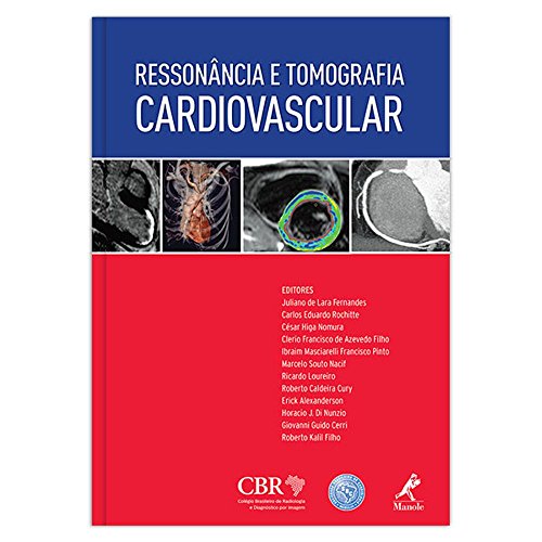 Ler Ressonância e tomografia cardiovascular, do autor Andreas Heuck Ler Ressonância e tomografia cardiovascular, do autor Andreas Heuck