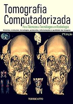 Tomografia Computadorizada, do autor Prof.tito Todescatto